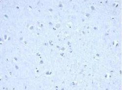 Isocitrate Dehydrogenase 1/IDH1 Rabbit anti-Human, Clone: IDH1/6806R, Novus